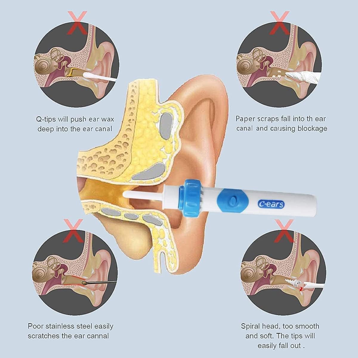 Electric Ear Wax Removal Kit, Ear Wax Removal Vacuum for Kids & Adults - Image 6