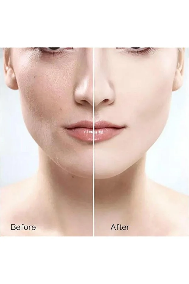 GELLO Skin Whitening Blemish Cream - Image 3