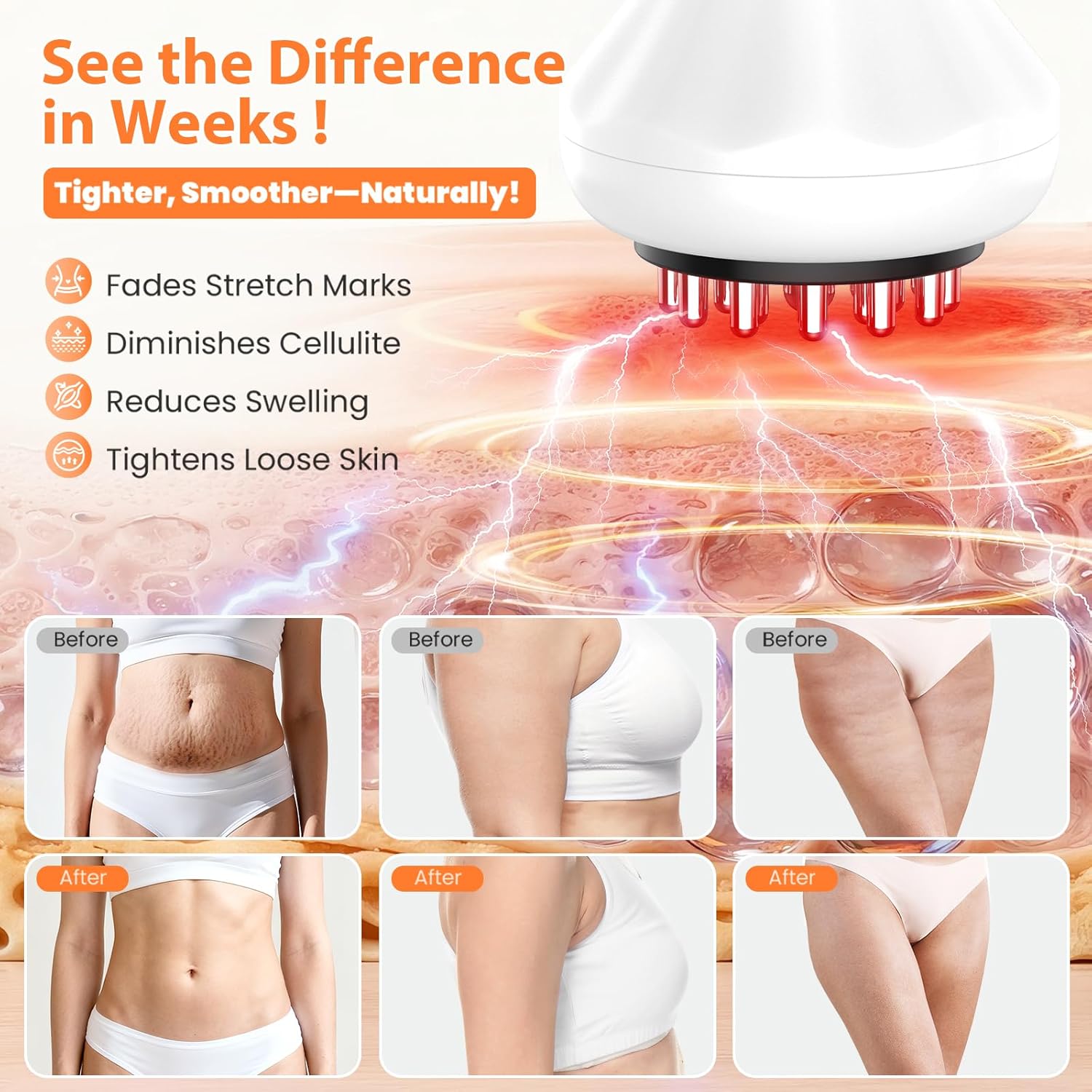 Body Sculpting Machine, Lymphatic Drainage Massager & Anti Cellulite Massage Tool, Helps Reduce Stretch Marks & Cellulite | Targeted Relief for Sciatica | Nerve, Hip, Joint, Muscle and Lower Back Pain - Image 4