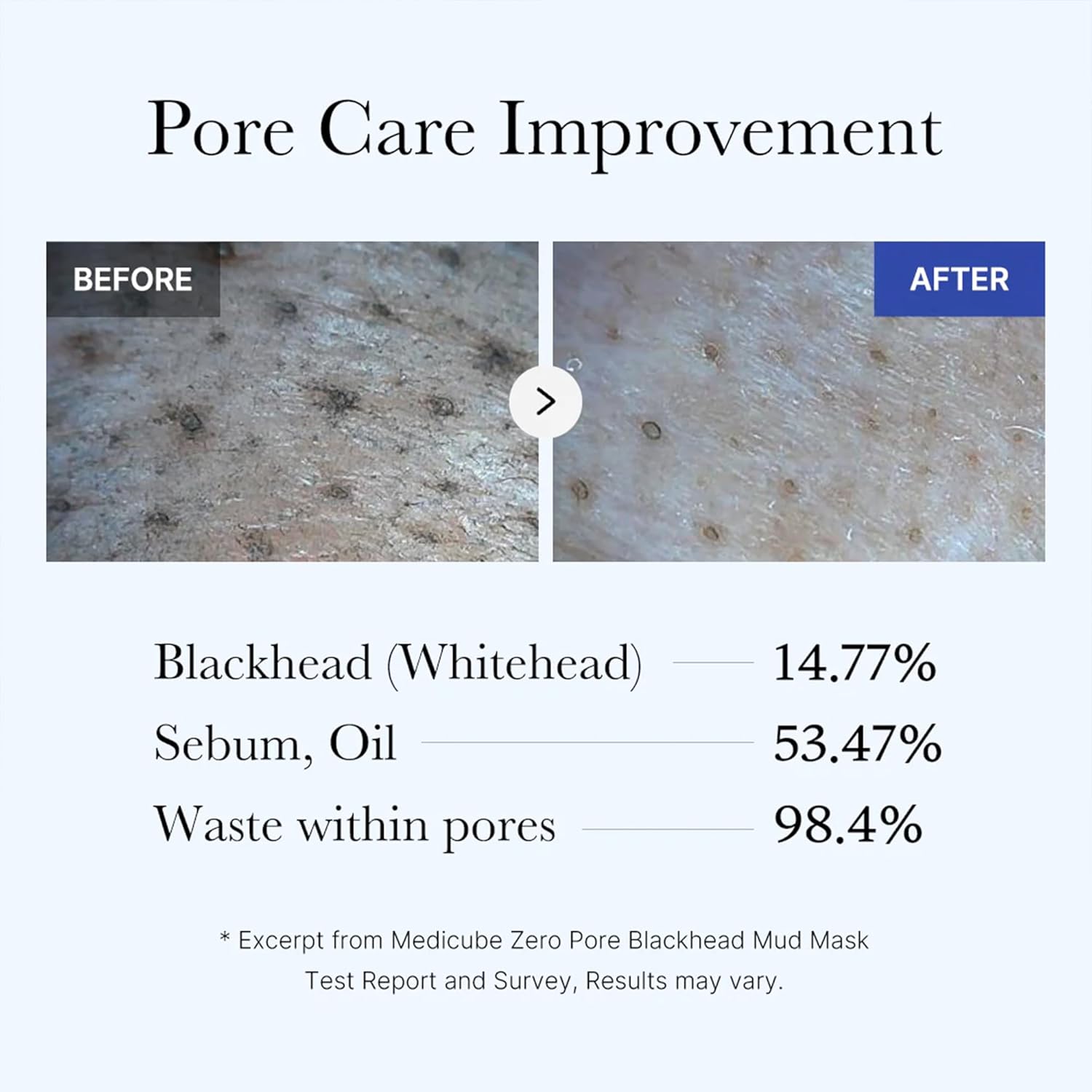 ZERO PORE Blackhead Mud Mask - Image 4