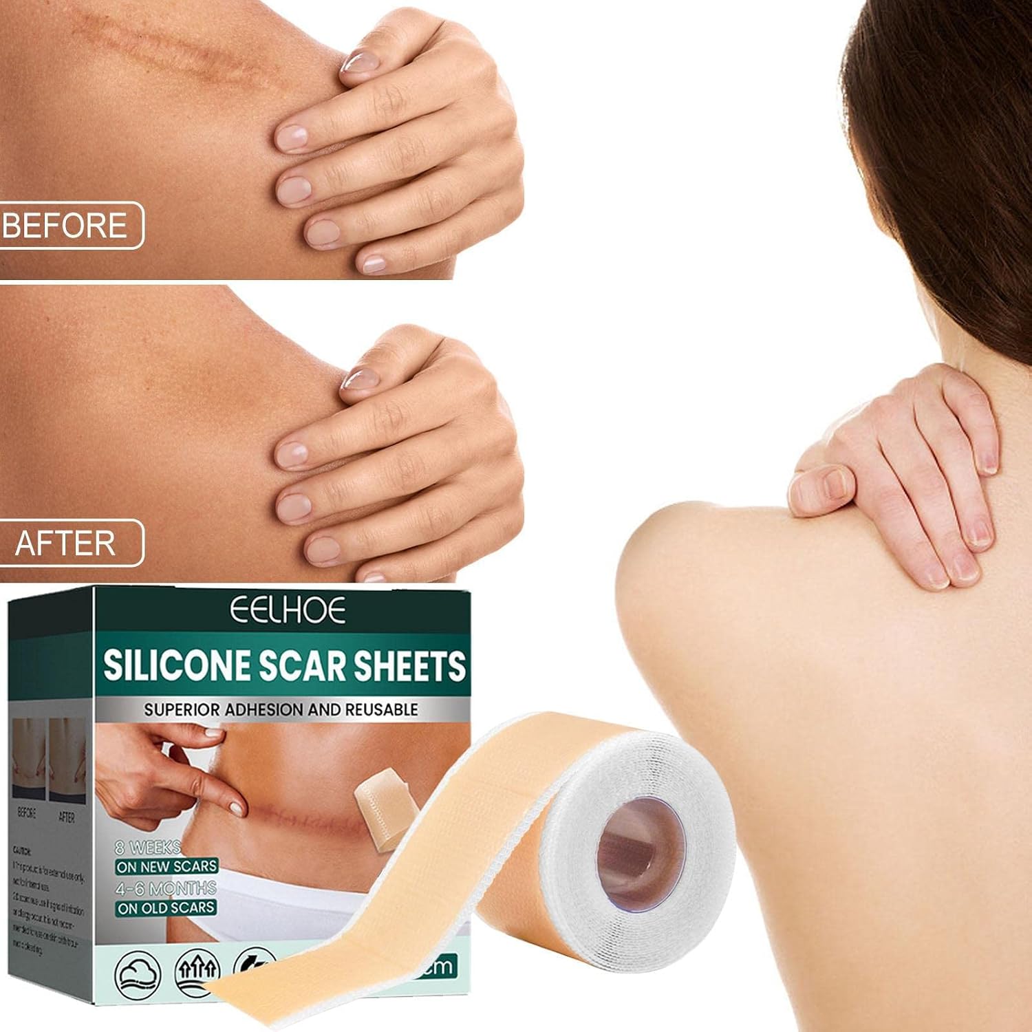 Scar Removal Patch, Self-Adhesive Silicone Sheets For Scars | Silicone Strips | Reusable - Image 7
