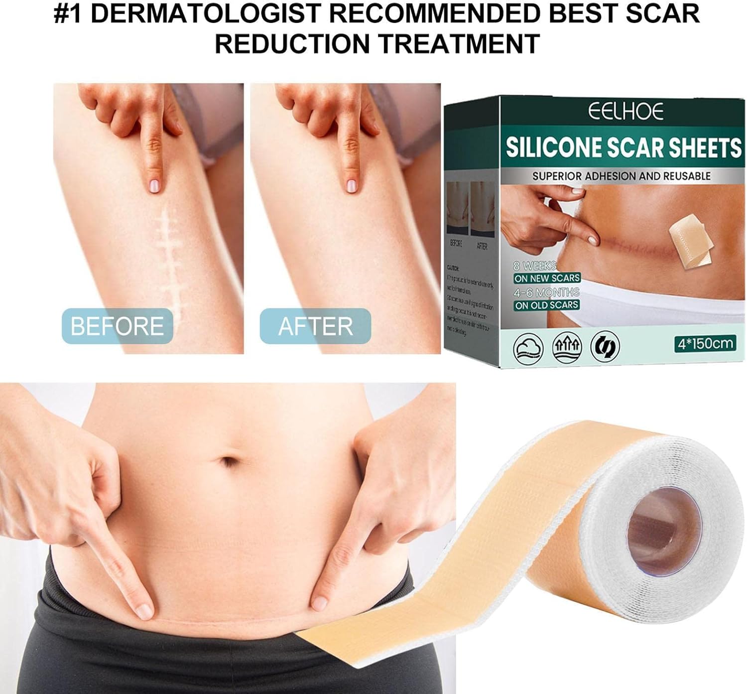 Scar Removal Patch, Self-Adhesive Silicone Sheets For Scars | Silicone Strips | Reusable - Image 6