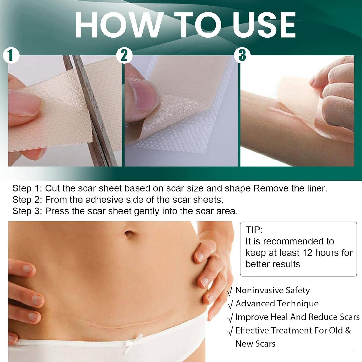 Scar Removal Patch, Self-Adhesive Silicone Sheets For Scars | Silicone Strips | Reusable - Image 5