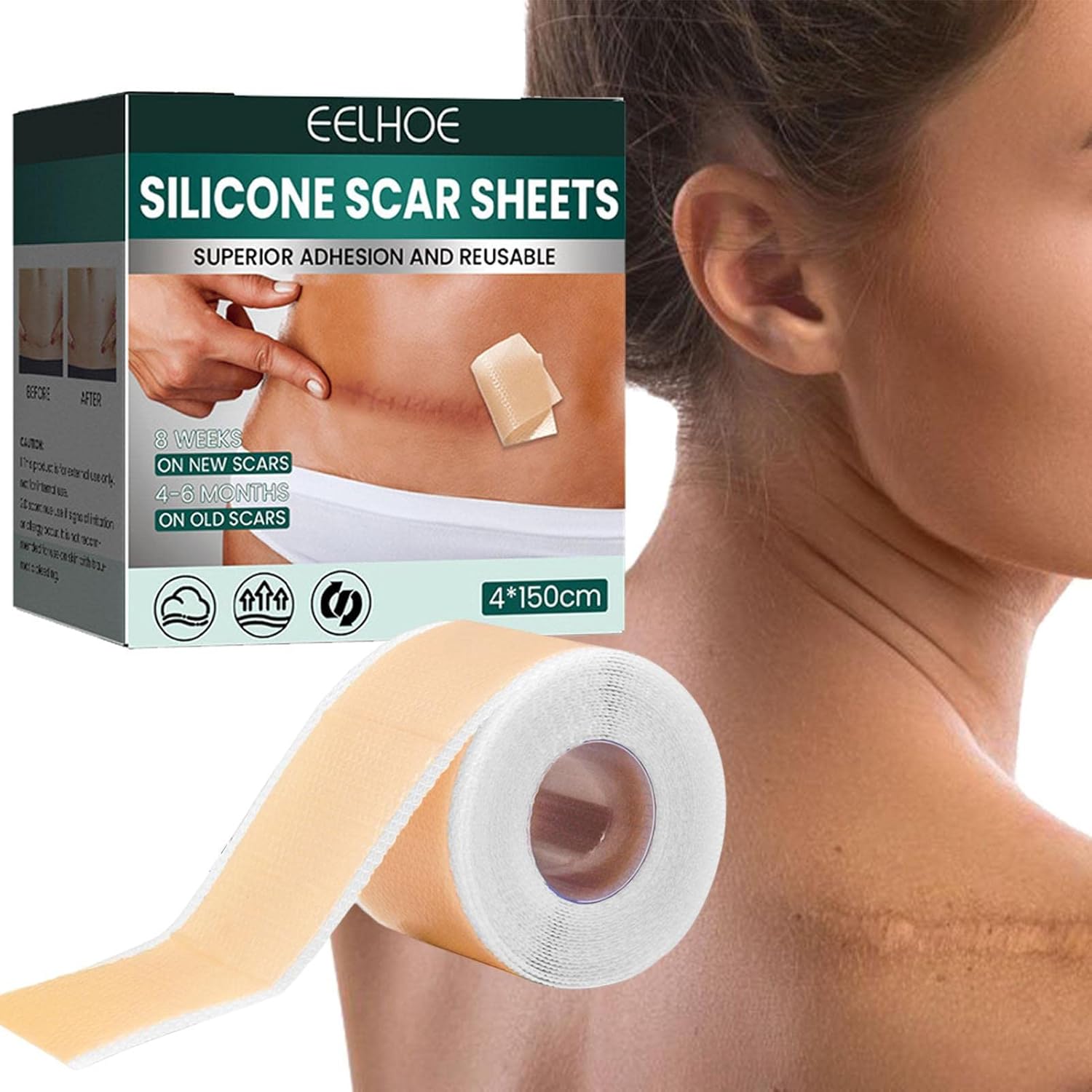 Scar Removal Patch, Self-Adhesive Silicone Sheets For Scars | Silicone Strips | Reusable - Image 2